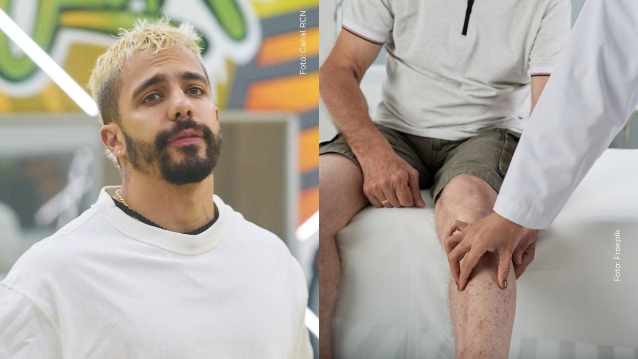 Altafulla mostró la recuperación de su intervención médica.