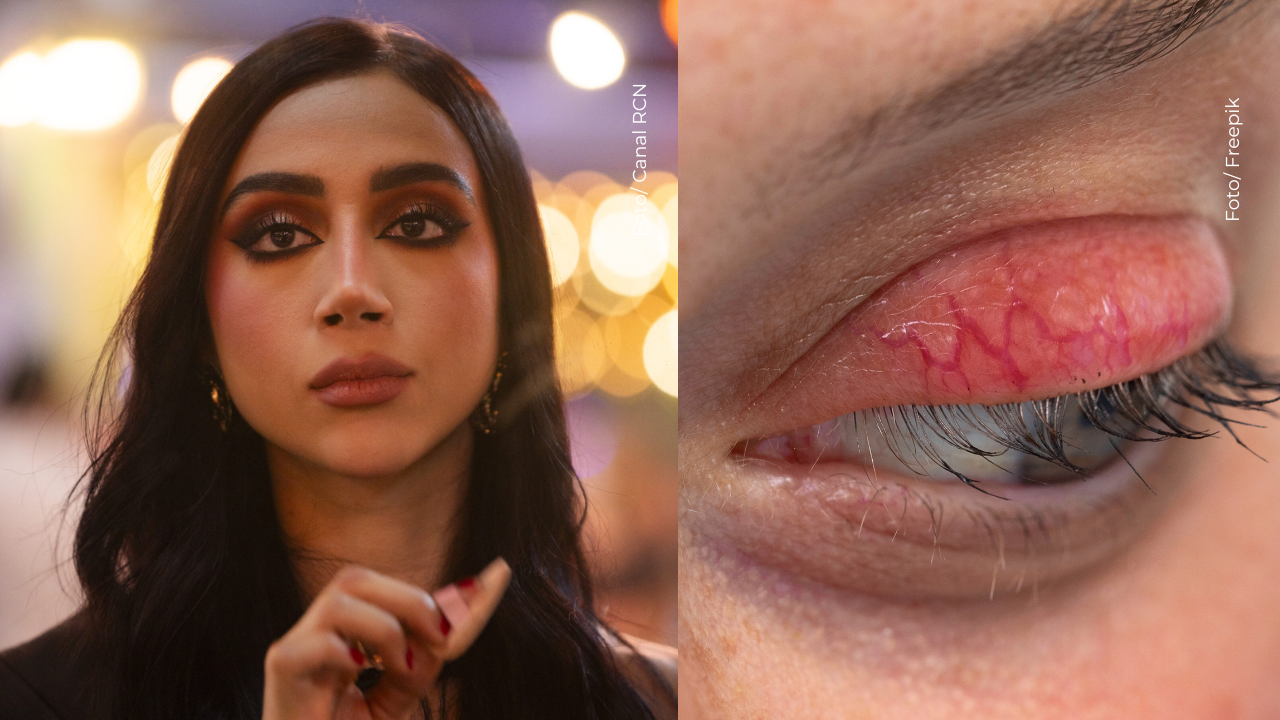 Beba preocupó al aparecer con un ojo morado