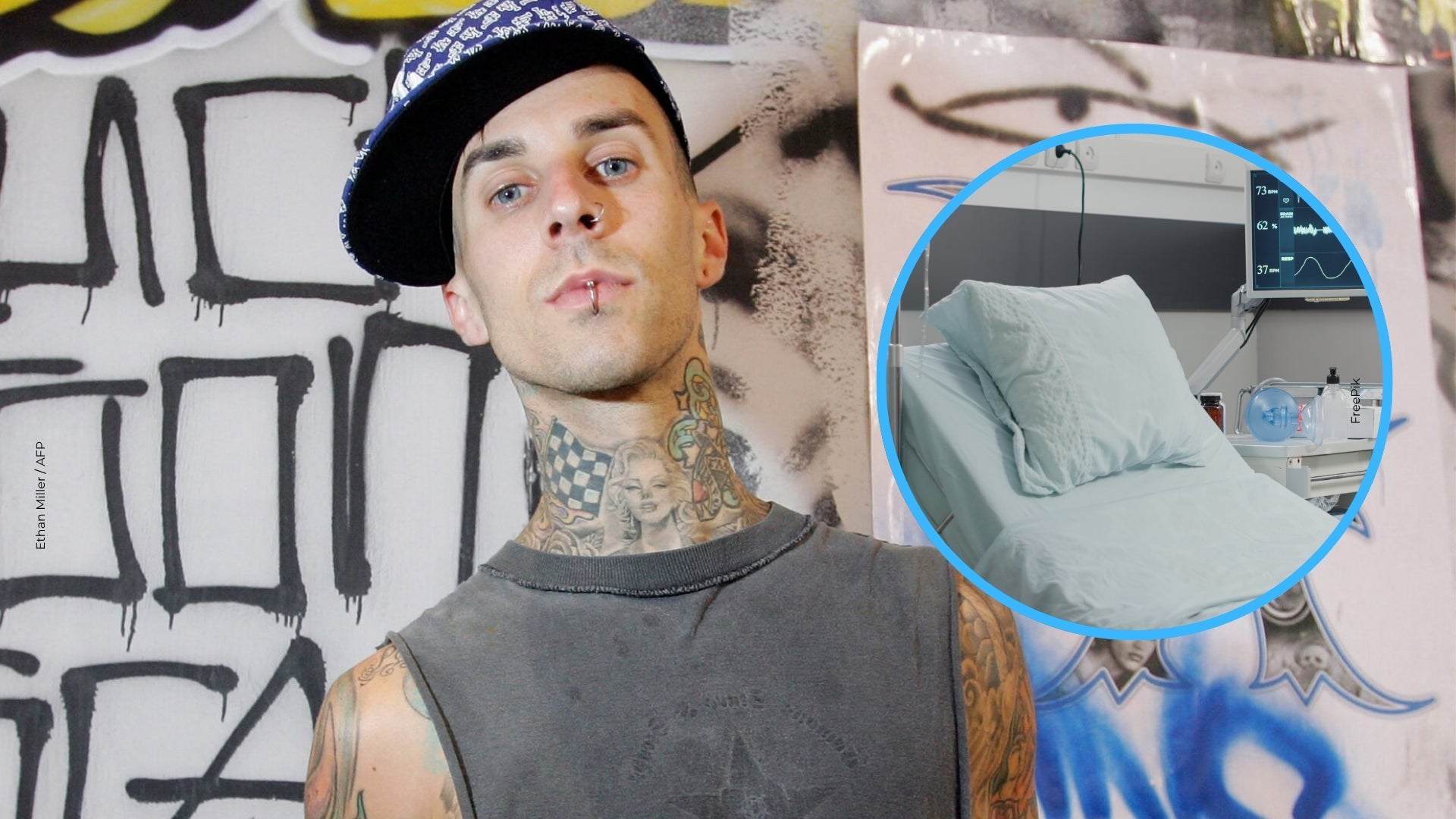 ¿Qué le sucedió a Travis Barker en el brazo?